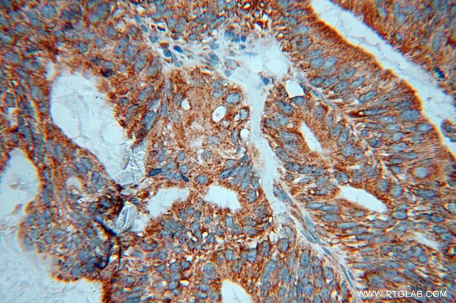 DNAJB11 Antibody in Immunohistochemistry (Paraffin) (IHC (P))