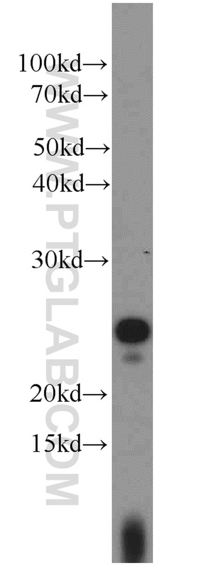 UBE2E3 Antibody in Western Blot (WB)