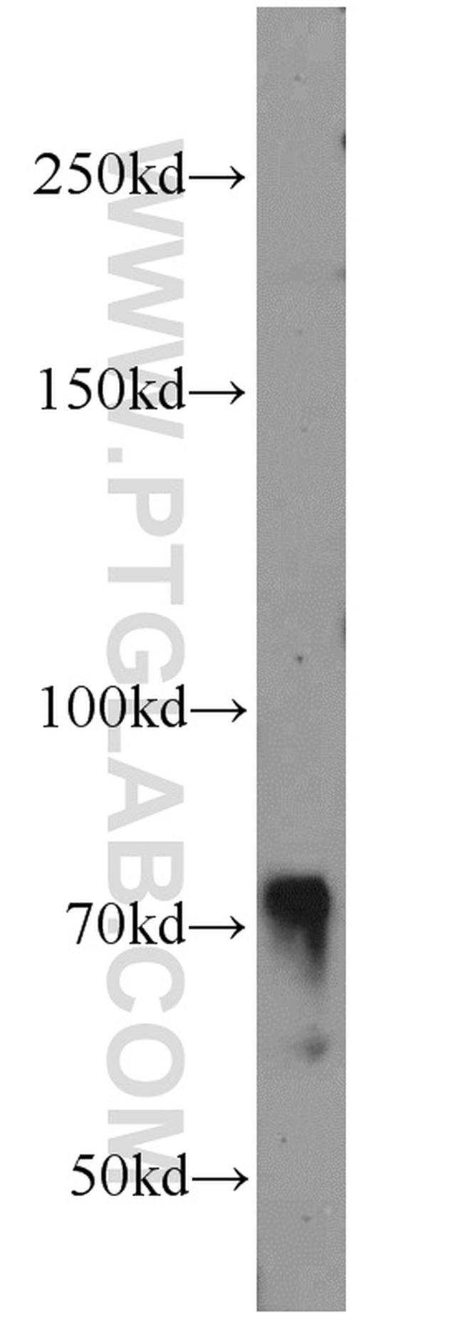 RUNX1T1 Antibody in Western Blot (WB)