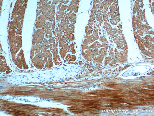 transgelin/SM22 Antibody in Immunohistochemistry (Paraffin) (IHC (P))