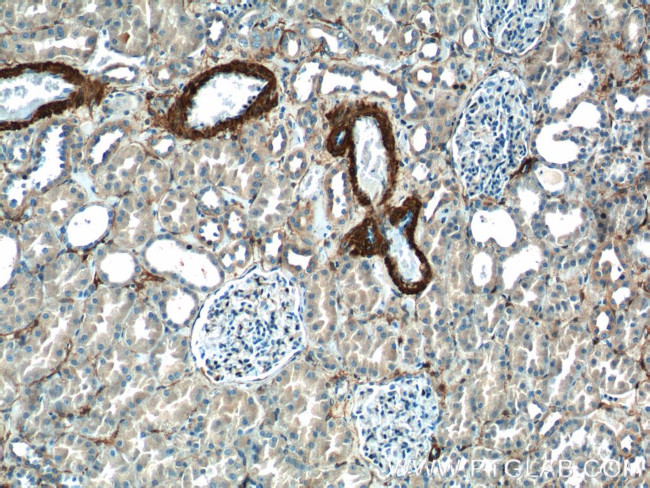 transgelin/SM22 Antibody in Immunohistochemistry (Paraffin) (IHC (P))