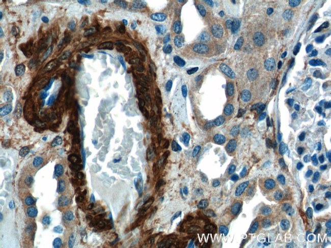 transgelin/SM22 Antibody in Immunohistochemistry (Paraffin) (IHC (P))