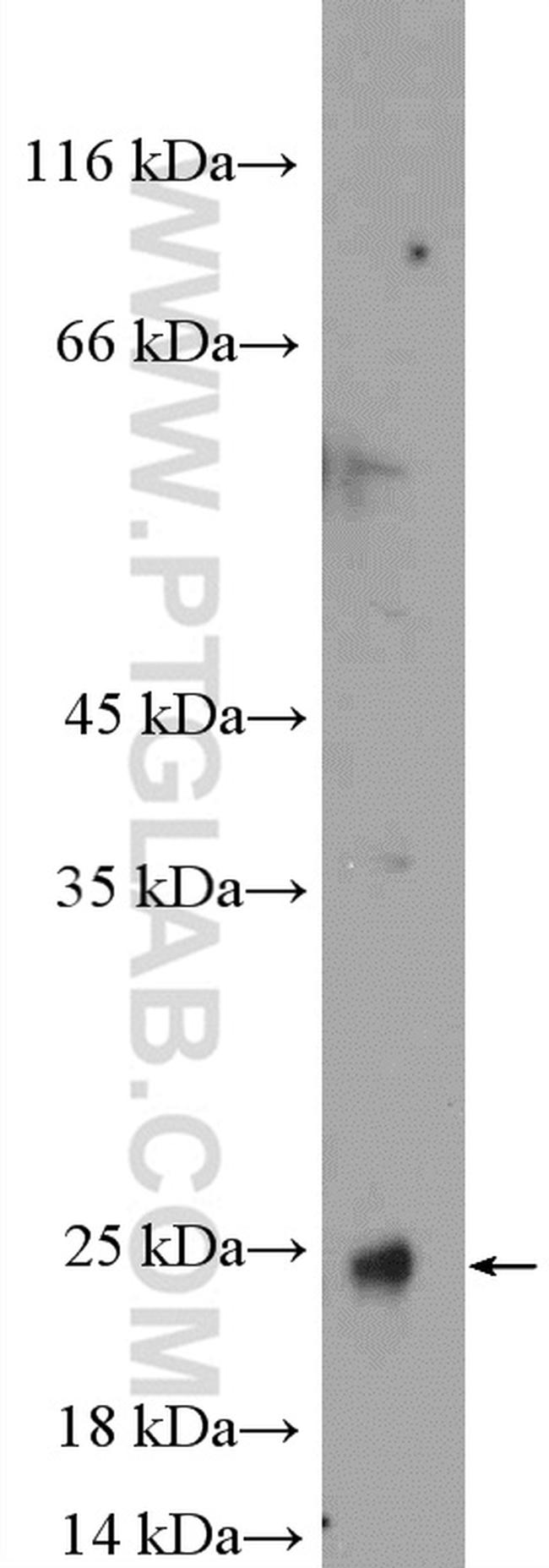 transgelin/SM22 Antibody in Western Blot (WB)