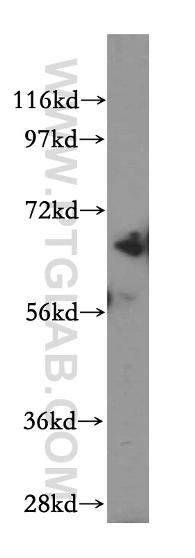 Beta galactosidase Antibody in Western Blot (WB)