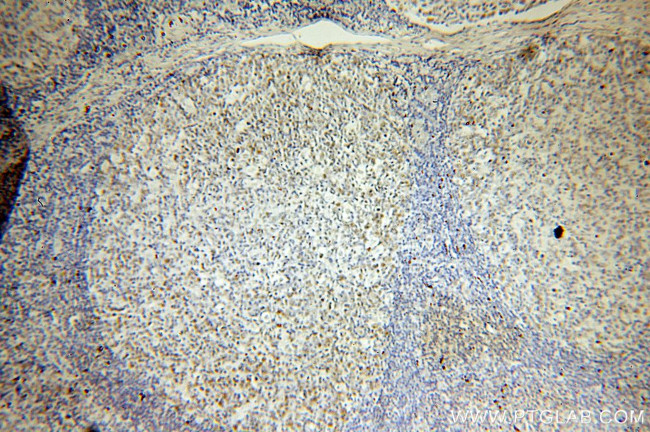 MSH2 Antibody in Immunohistochemistry (Paraffin) (IHC (P))