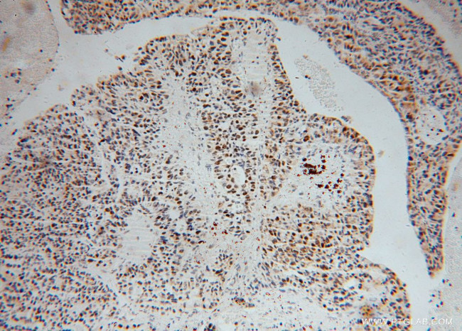 MSH2 Antibody in Immunohistochemistry (Paraffin) (IHC (P))