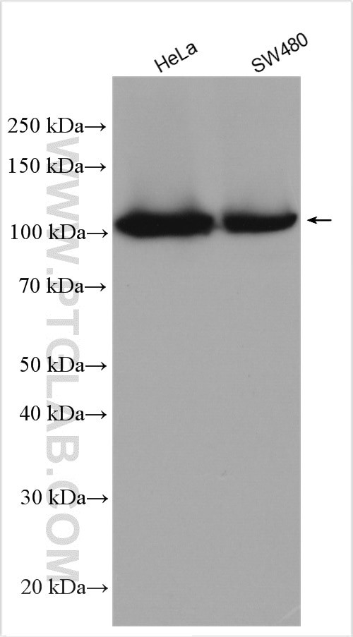 MSH2 Antibody in Western Blot (WB)