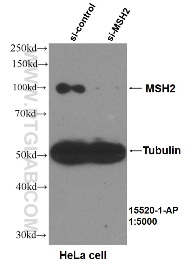 MSH2 Antibody in Western Blot (WB)