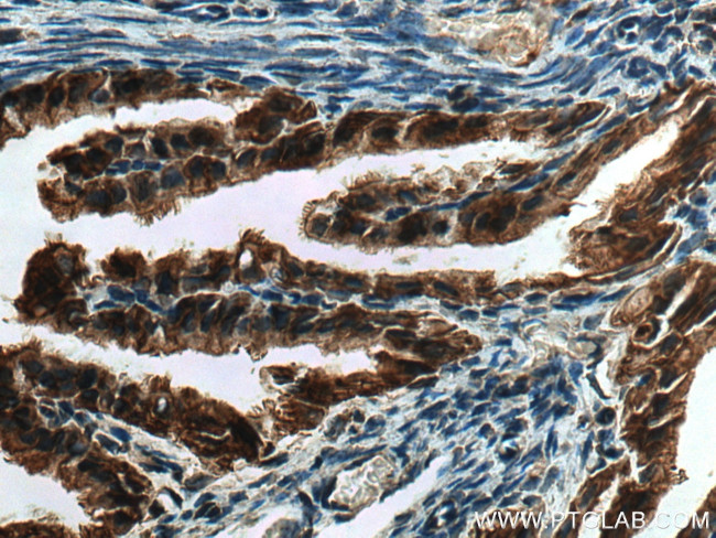 PRSS8 Antibody in Immunohistochemistry (Paraffin) (IHC (P))