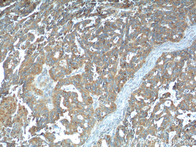 PRSS8 Antibody in Immunohistochemistry (Paraffin) (IHC (P))