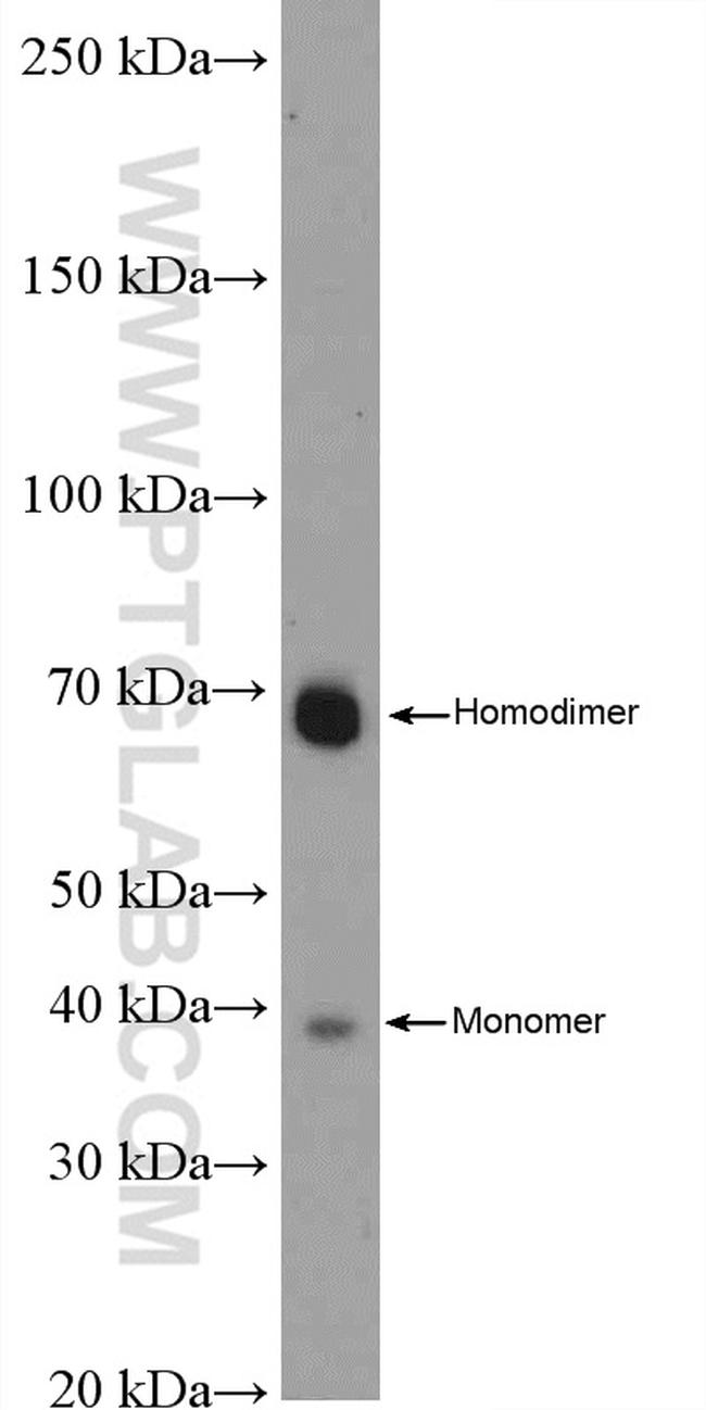 PRSS8 Antibody in Western Blot (WB)