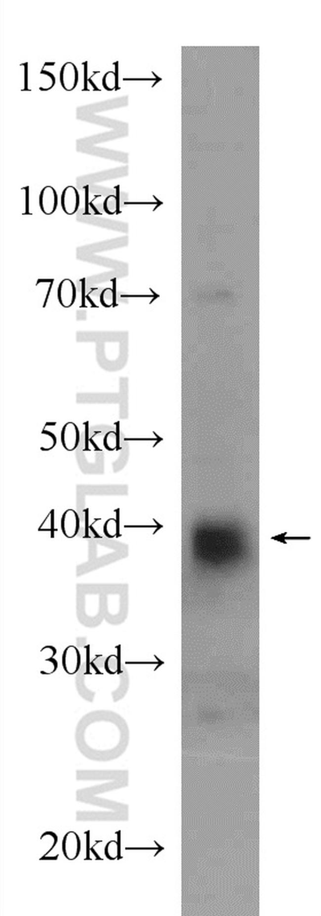 PRSS8 Antibody in Western Blot (WB)