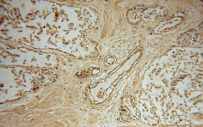 PRSS8 Antibody in Immunohistochemistry (Paraffin) (IHC (P))