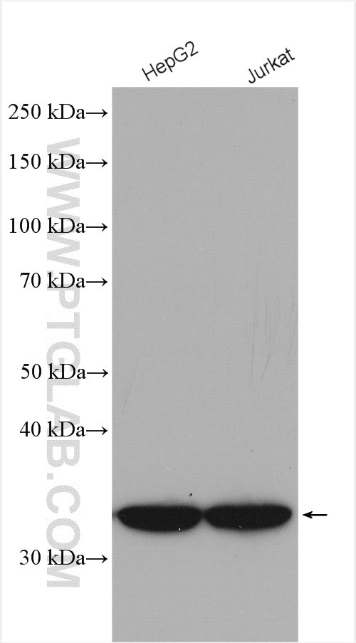 MTX1 Antibody in Western Blot (WB)