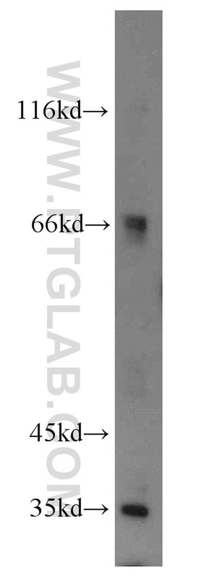 MTX1 Antibody in Western Blot (WB)