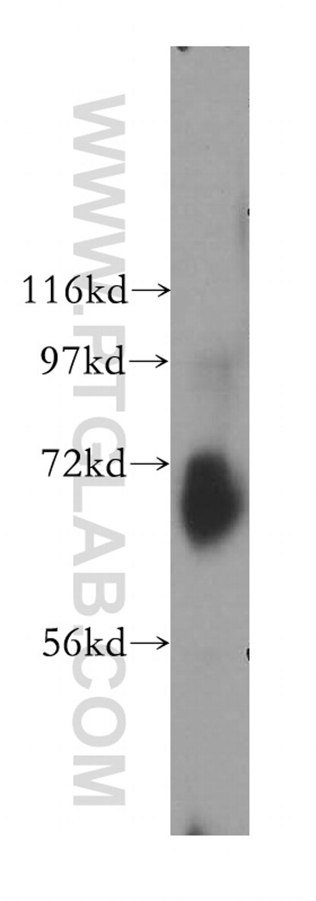 MTX1 Antibody in Western Blot (WB)