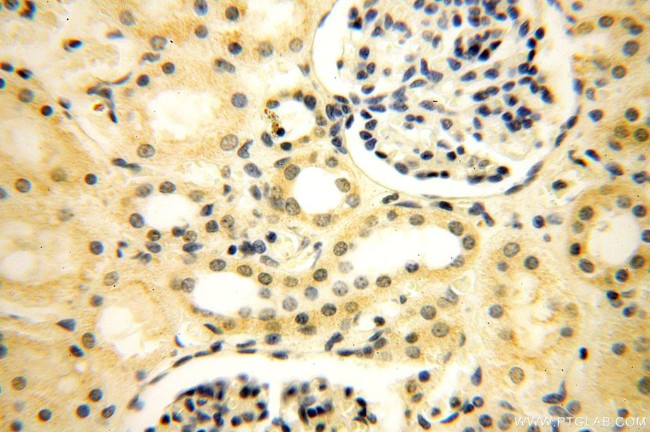 WDR5 Antibody in Immunohistochemistry (Paraffin) (IHC (P))