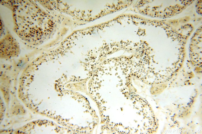 WDR5 Antibody in Immunohistochemistry (Paraffin) (IHC (P))