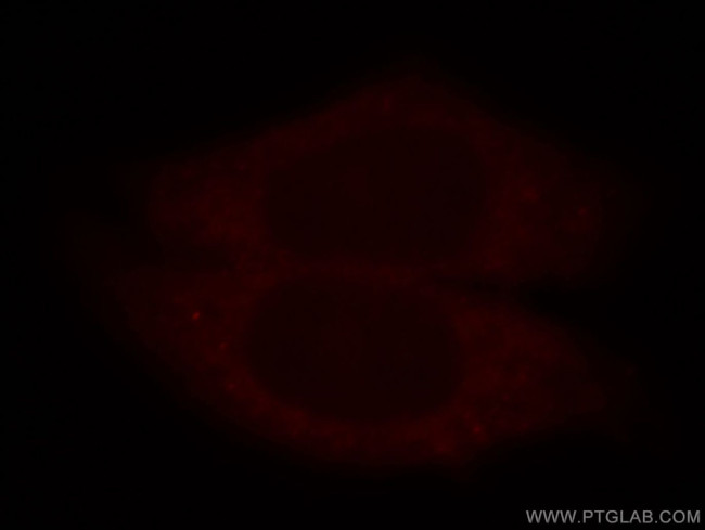 PRPS1 Antibody in Immunocytochemistry (ICC/IF)