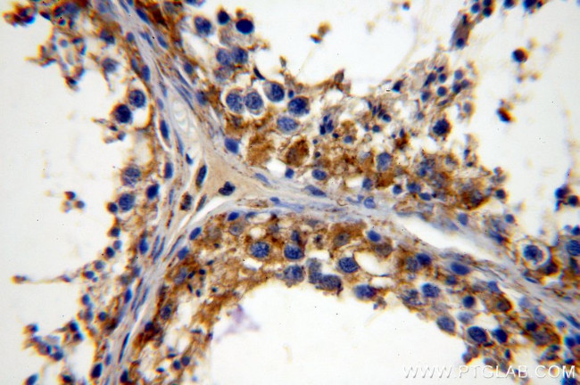 PRPS1 Antibody in Immunohistochemistry (Paraffin) (IHC (P))