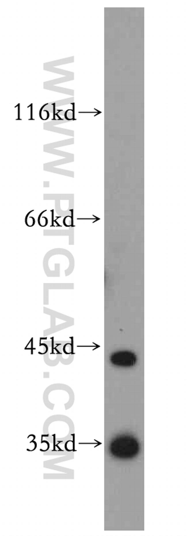 PRPS1 Antibody in Western Blot (WB)