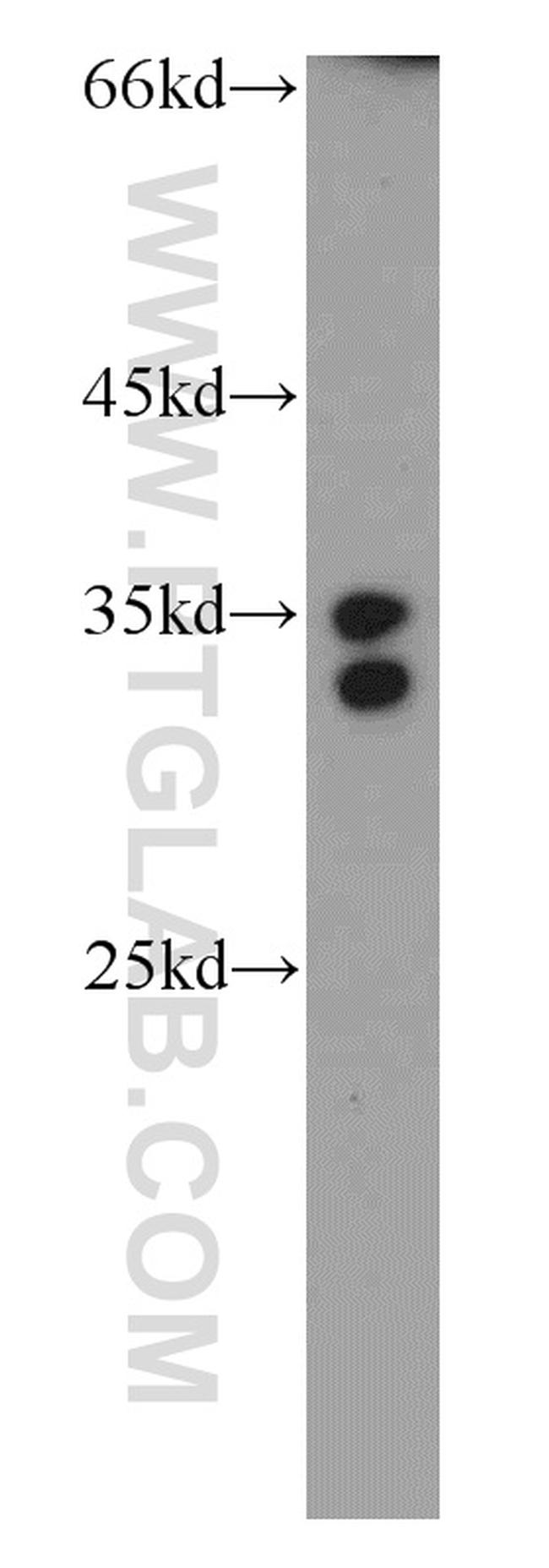 PRPS1 Antibody in Western Blot (WB)