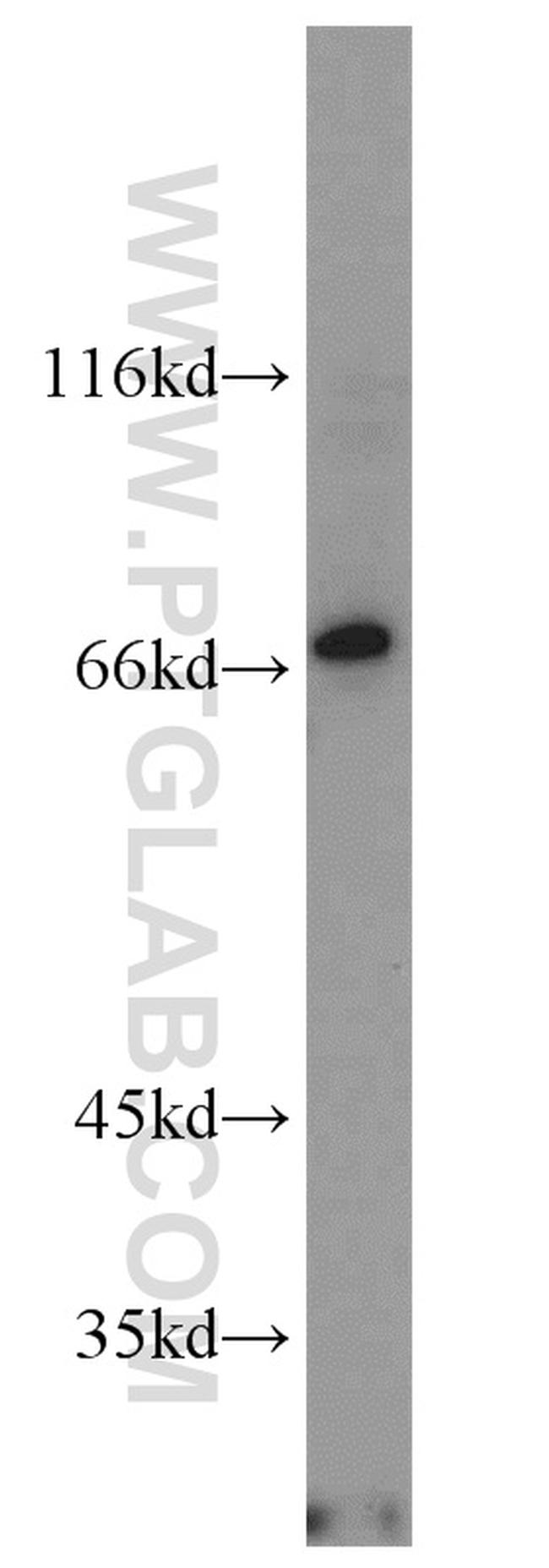 NOXA2/p67phox Antibody in Western Blot (WB)