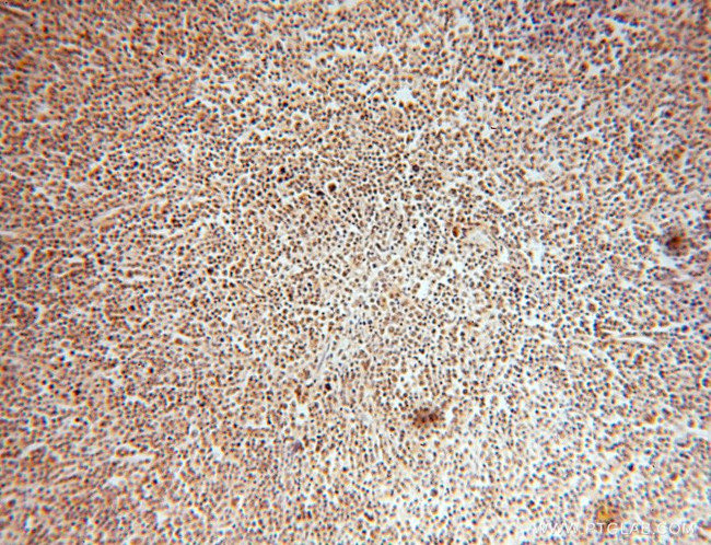 HMGB2 Antibody in Immunohistochemistry (Paraffin) (IHC (P))