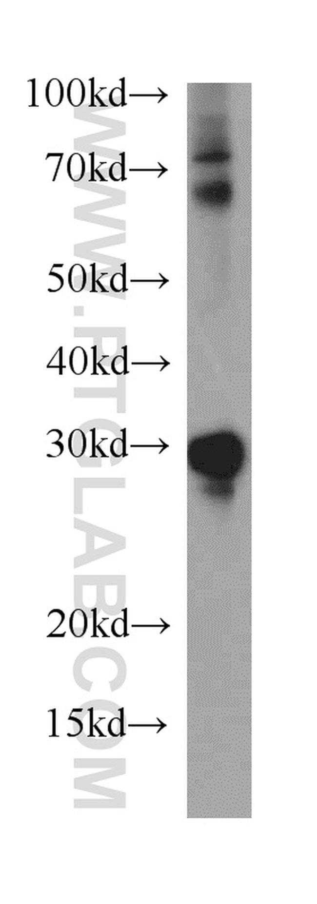 HMGB2 Antibody in Western Blot (WB)