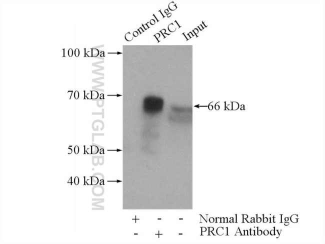 PRC1 Antibody in Immunoprecipitation (IP)
