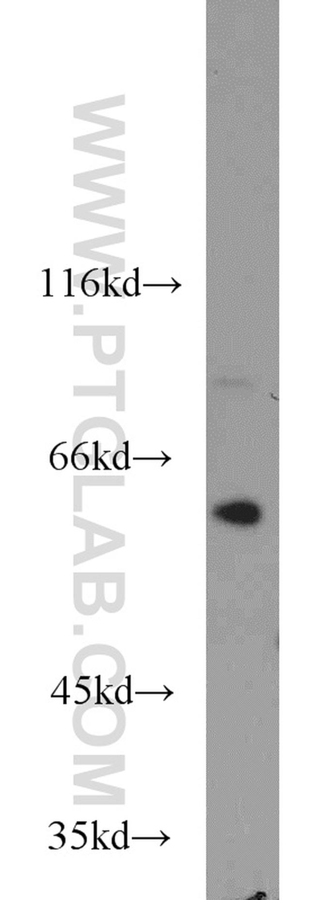 U2AF65 Antibody in Western Blot (WB)