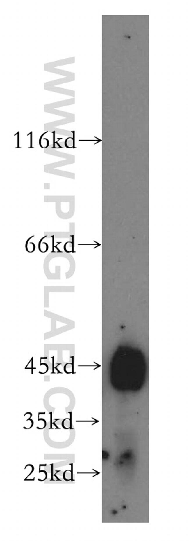 HSDL2 Antibody in Western Blot (WB)