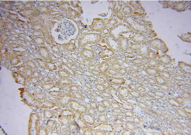 OPA3 Antibody in Immunohistochemistry (Paraffin) (IHC (P))