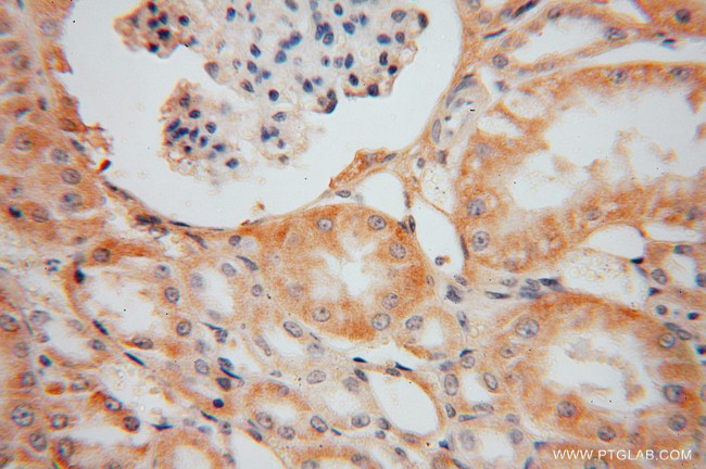 OPA3 Antibody in Immunohistochemistry (Paraffin) (IHC (P))