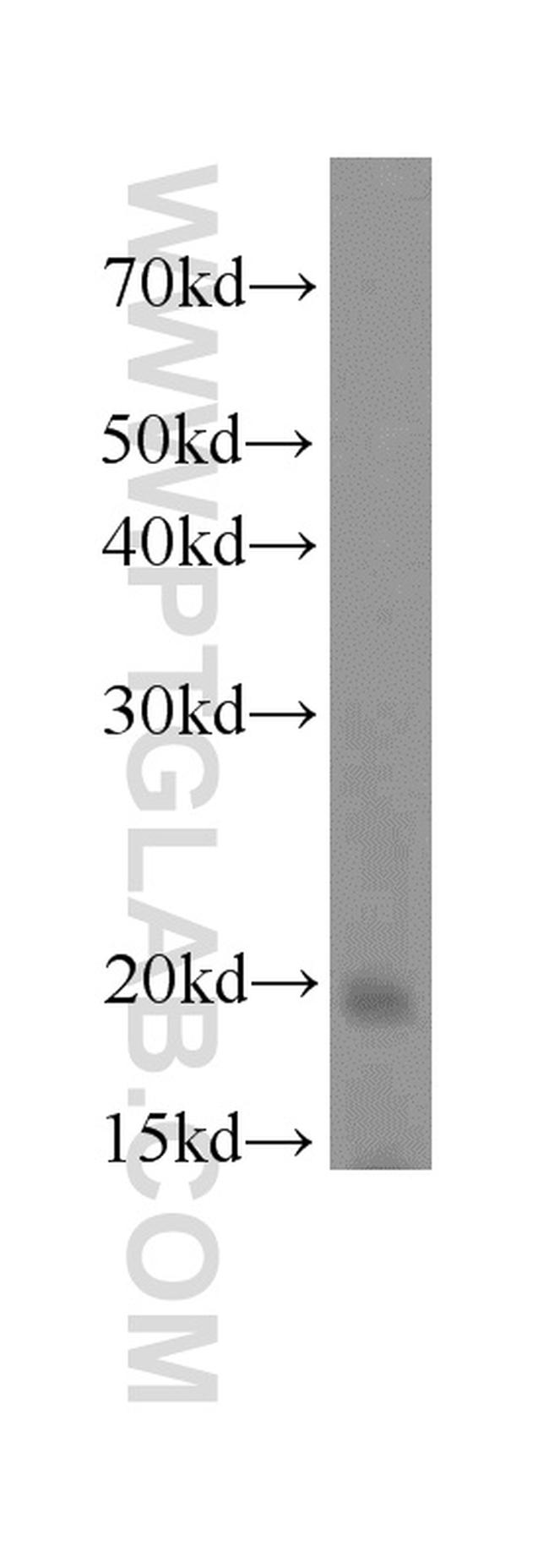 OPA3 Antibody in Western Blot (WB)