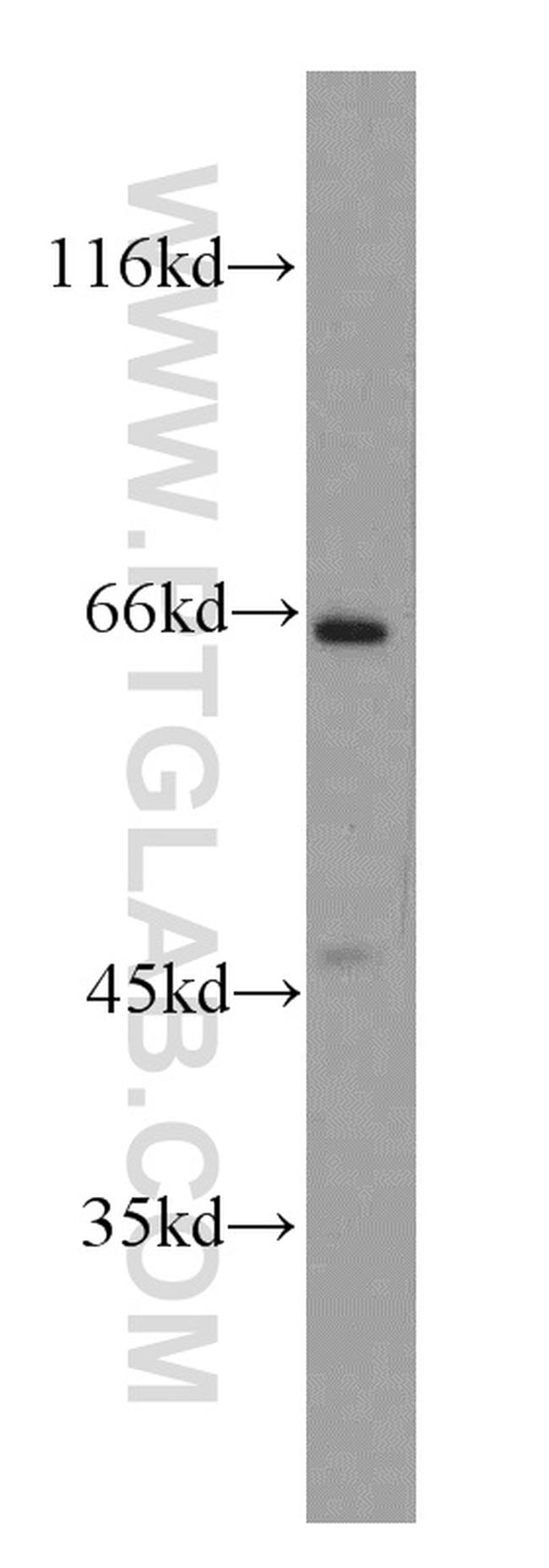 SH2D3A Antibody in Western Blot (WB)