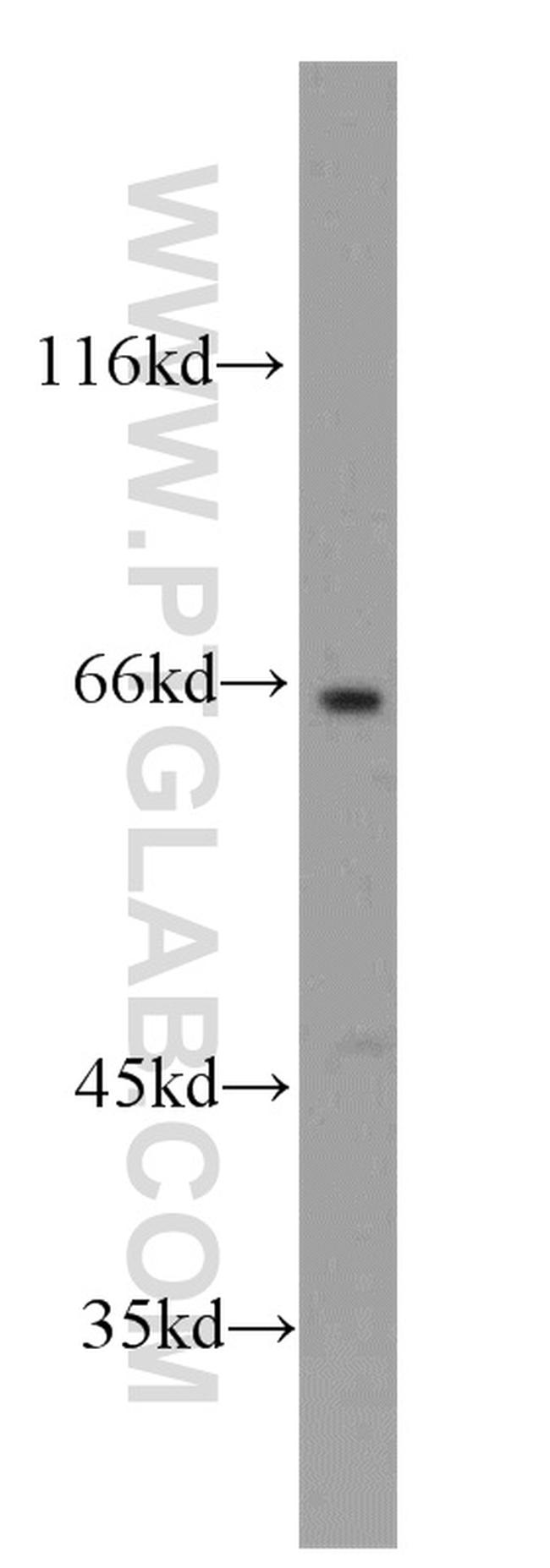 SH2D3A Antibody in Western Blot (WB)