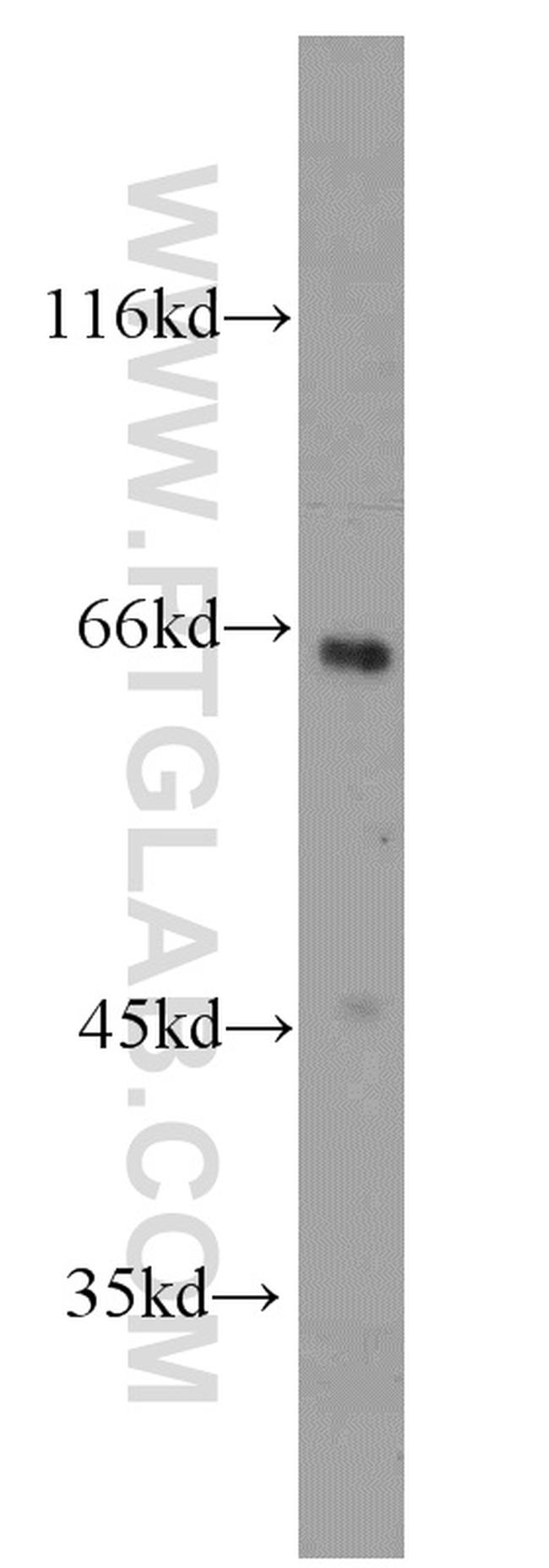 SH2D3A Antibody in Western Blot (WB)