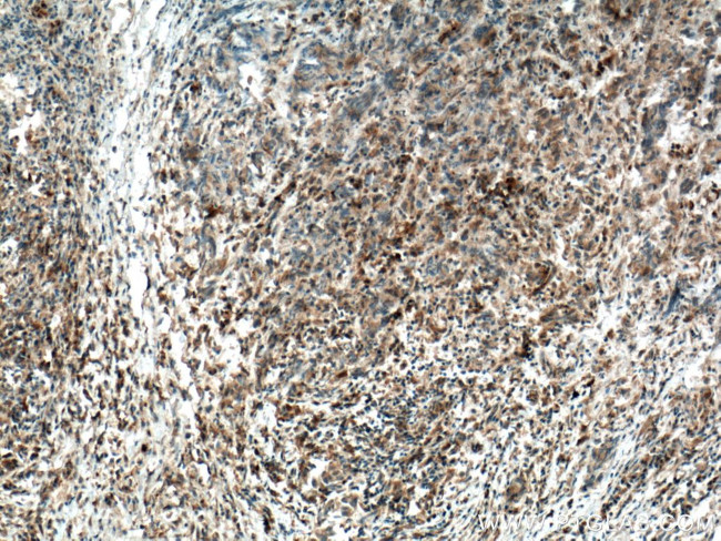 IKBKB Antibody in Immunohistochemistry (Paraffin) (IHC (P))