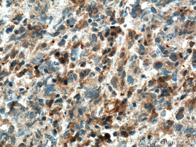 IKBKB Antibody in Immunohistochemistry (Paraffin) (IHC (P))