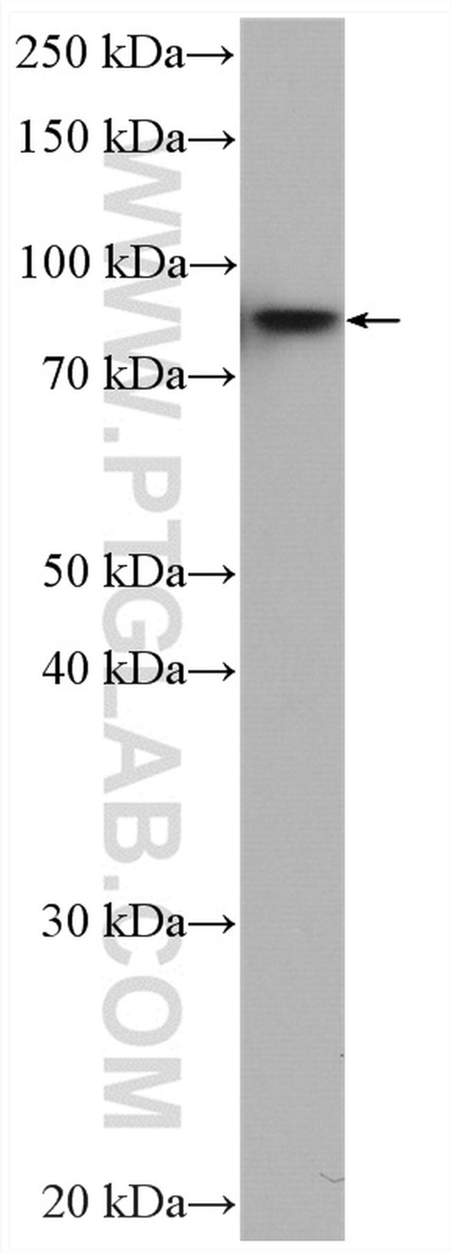 IKBKB Antibody in Western Blot (WB)