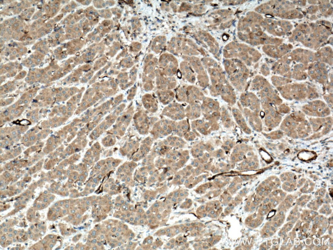 IKBKB Antibody in Immunohistochemistry (Paraffin) (IHC (P))