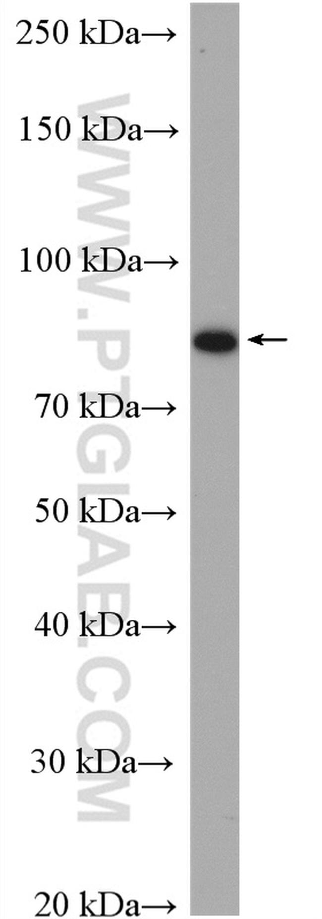 IKBKB Antibody in Western Blot (WB)