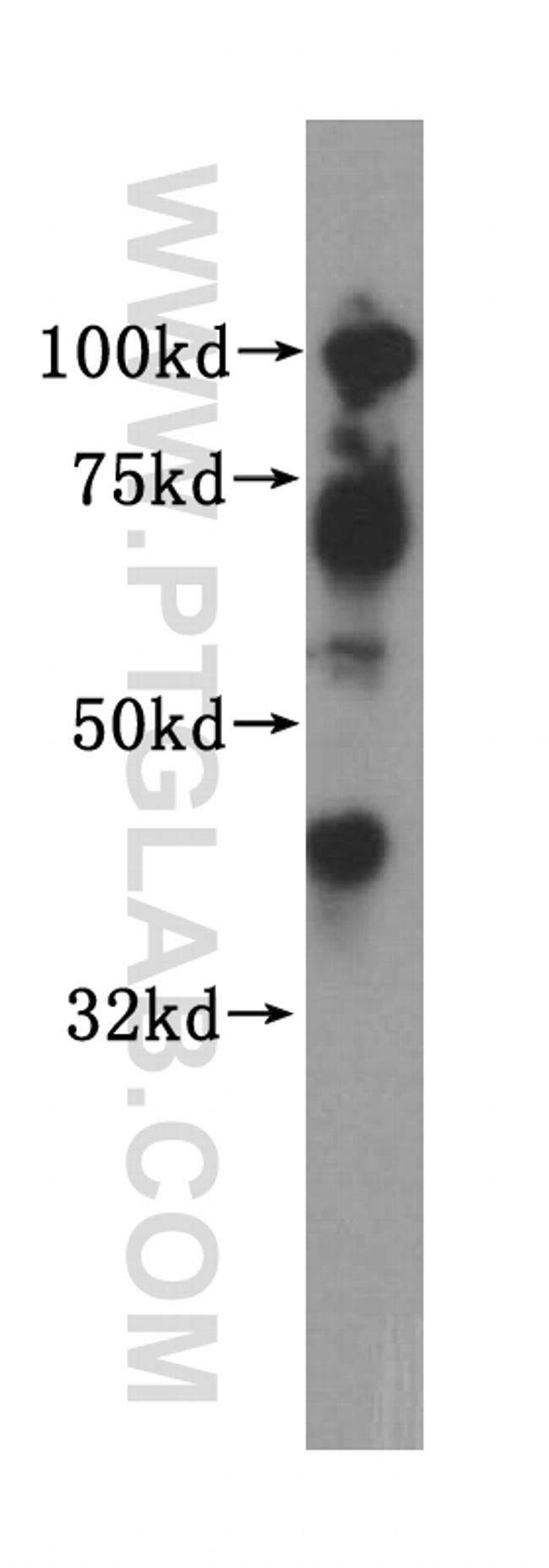 Islet 1 Antibody in Western Blot (WB)