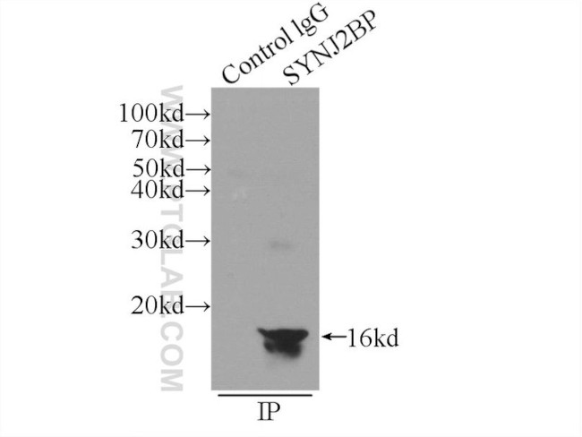 SYNJ2BP Antibody in Immunoprecipitation (IP)