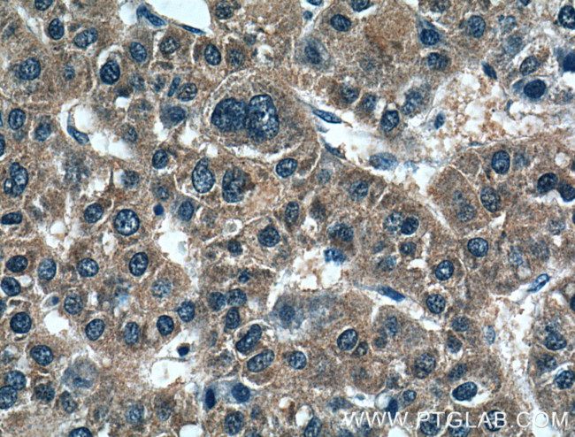 PMVK Antibody in Immunohistochemistry (Paraffin) (IHC (P))