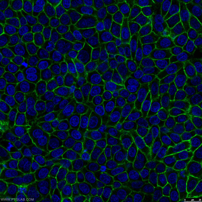 CD44 Antibody in Immunocytochemistry (ICC/IF)