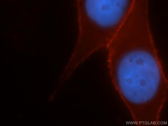 CD44 Antibody in Immunocytochemistry (ICC/IF)