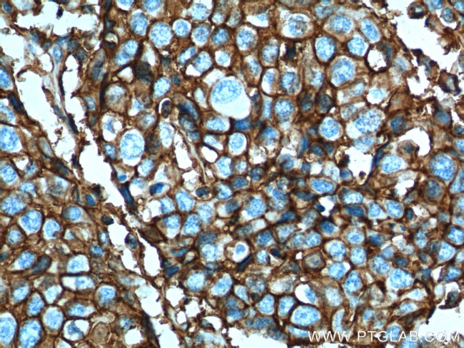 CD44 Antibody in Immunohistochemistry (Paraffin) (IHC (P))