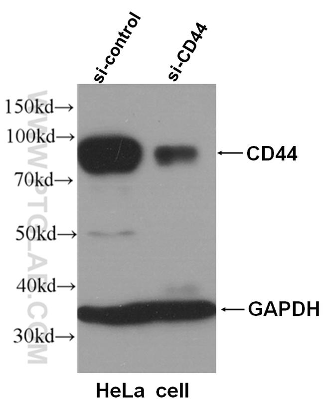 CD44 Antibody in Western Blot (WB)